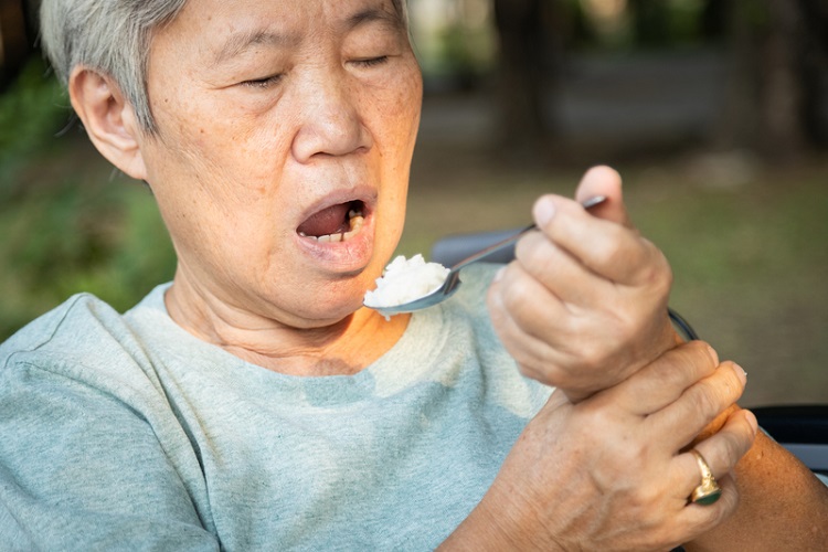 巴金森氏症症狀