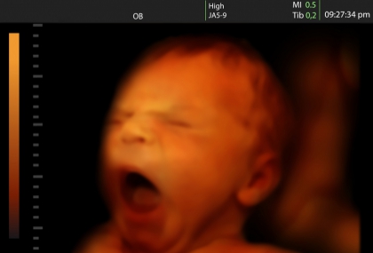 *