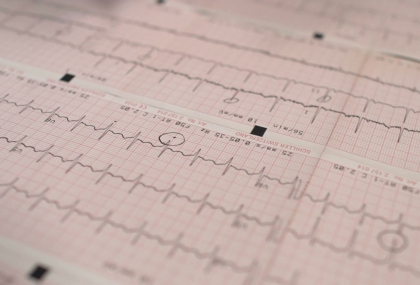心臟科醫師揭早晨「傷心5習慣」！空腹咖啡、甜早餐、加工肉品恐增加心血管負擔